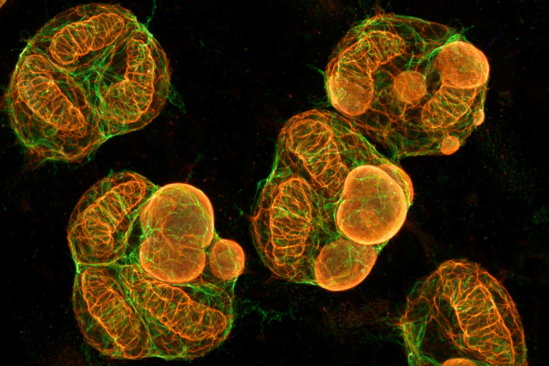 Fluorescence microscope view of immune cells with glowing orange-green mitochondrial networks against a dark background (illustrative image)