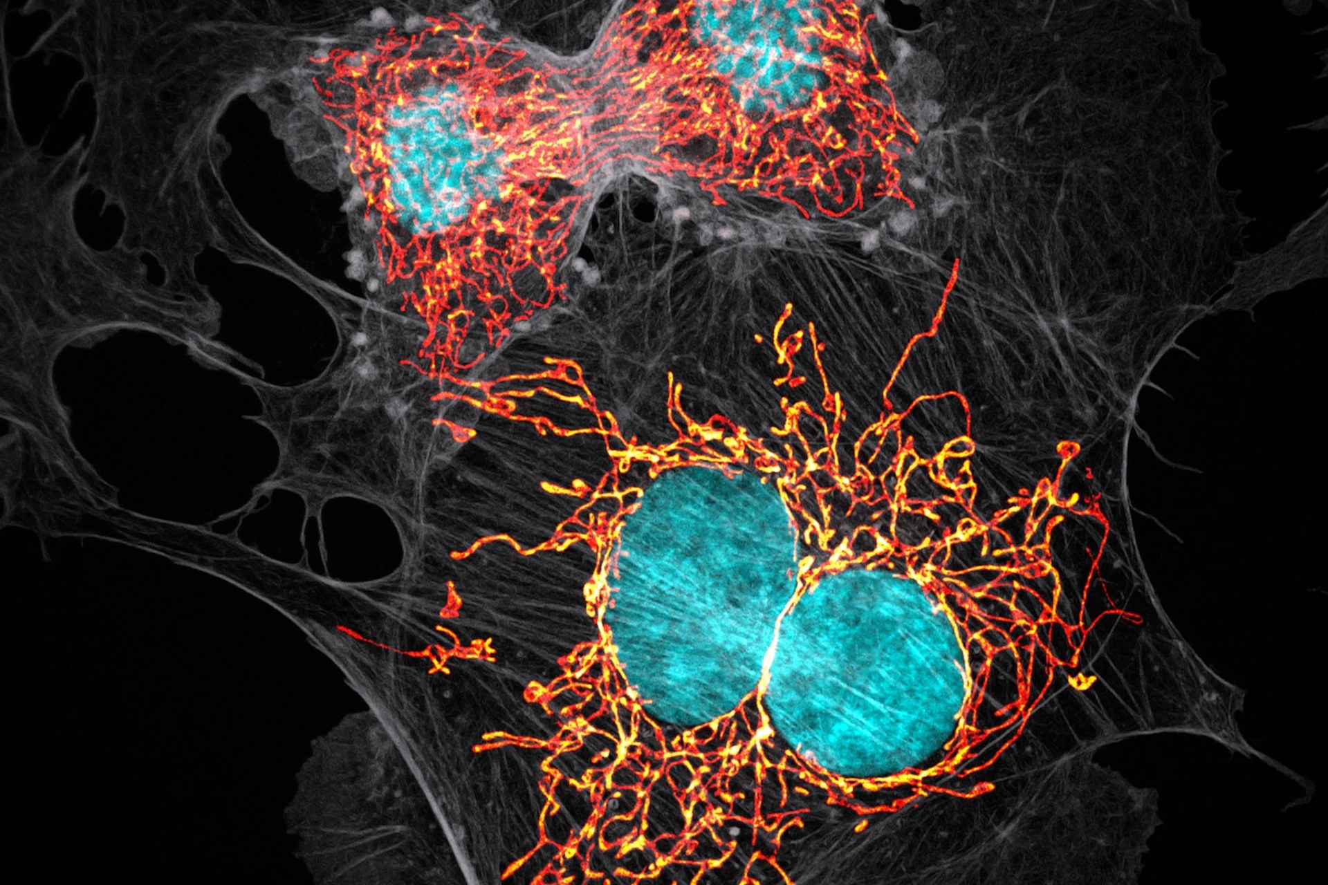 Confocal microscopy photograph showing mitochondria (orange) clustered around cell nuclei (blue) in cultured cells. Photograph: Jason Kirk, Nikon Small World competition; illustrative only.